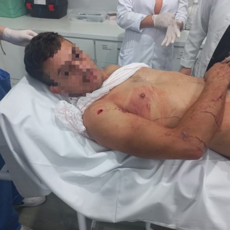 Mulher tenta matar marido pela segunda vez a golpes de faca