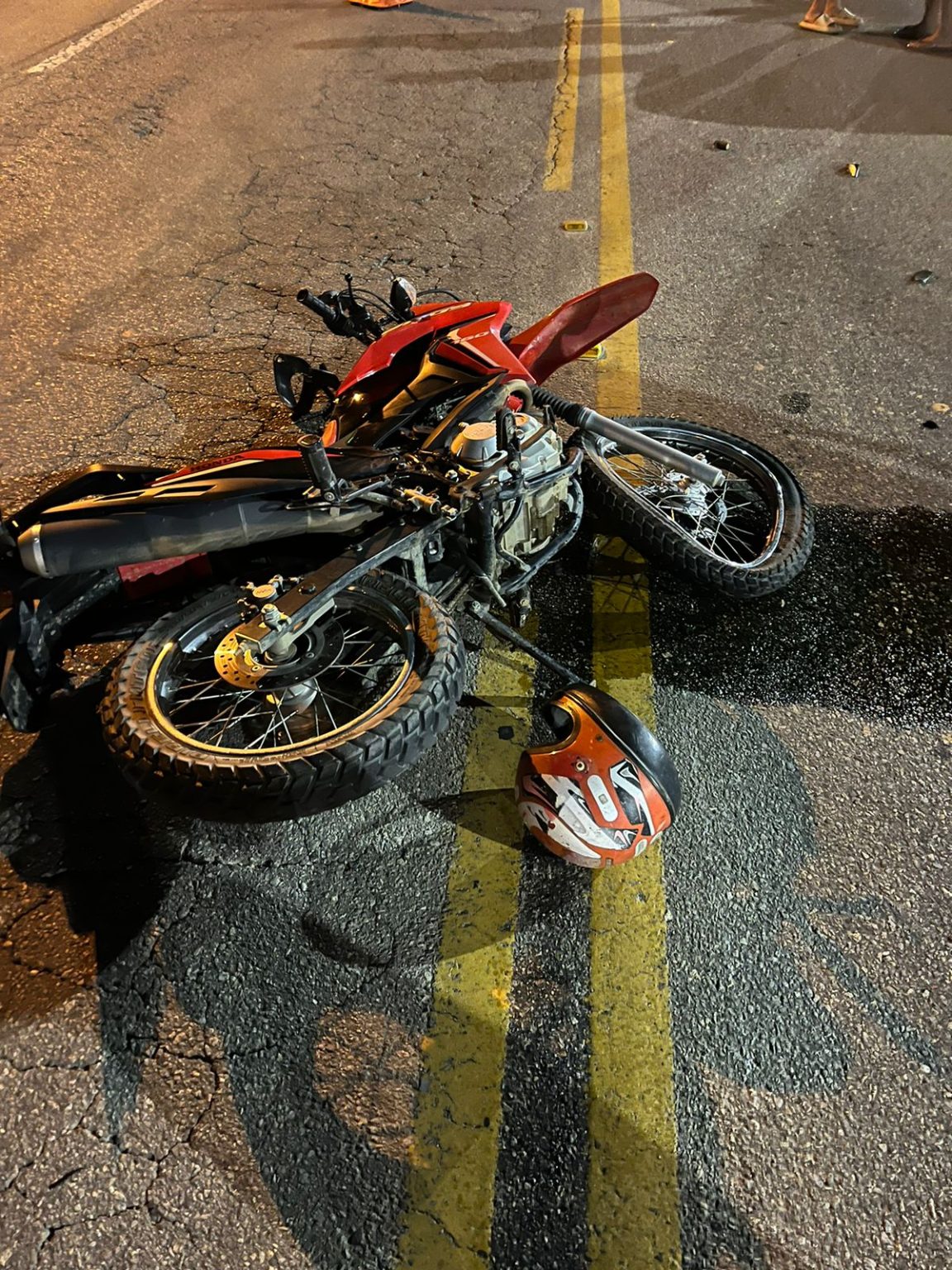 Homem sofre amputação após grave acidente no Norte de Santa Catarina