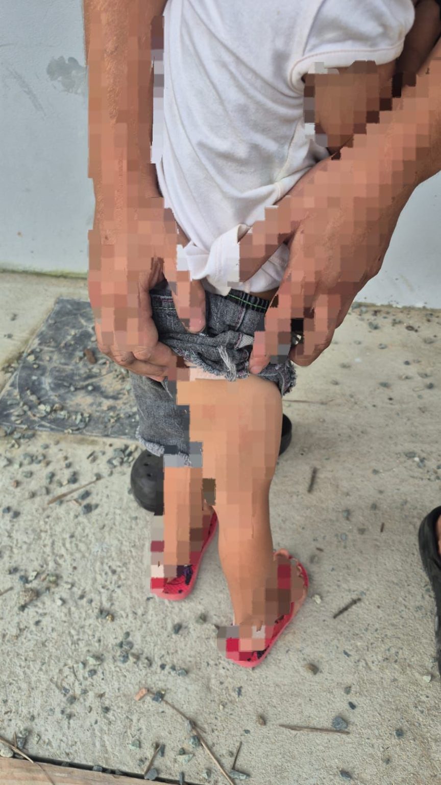 Mãe é presa em SC por tortura contra filha de 3 anos e exposição da bebê ‘nua’ nas redes sociais